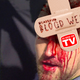 Illustration for article titled Body Parts Do Not Bend That Way: Gruesome Sports Injuries As Seen On TV
